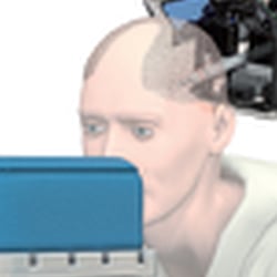 HAARTRANSPLANTATOIN-ROBOTER / HAIR TRANSPLANT ROBOT