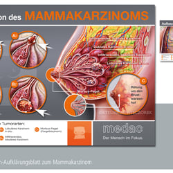 Mammakarzinom2