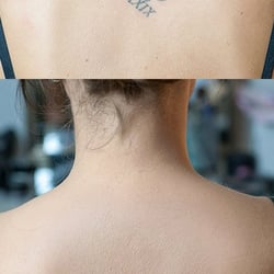 Vorher/Nachher Tattoo abdecken
