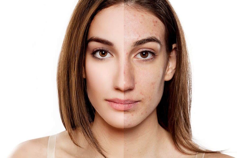 RETOUCH1