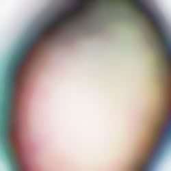 Germinal – 35,56 cm