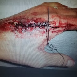 Sfx-Make-up, Naht, Eiter und Blut